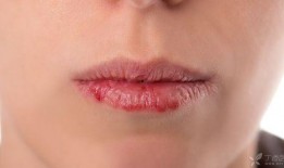 吃瓜嘴角流血图片,揭秘网络热议背后的真相