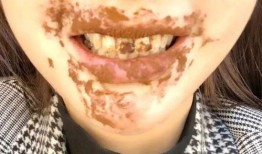 吃瓜嘴角流血图片,揭秘网络热议背后的真相